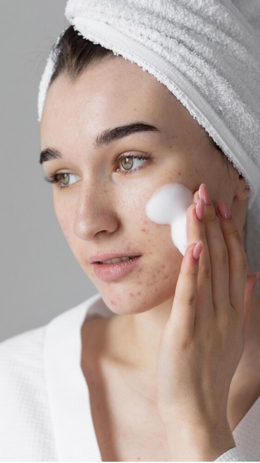 Perdona aplicandose productos del acné